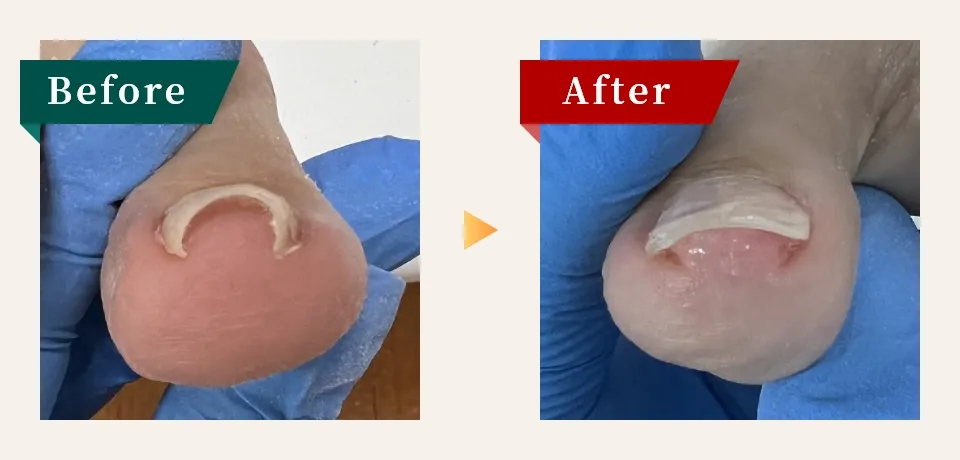 ビフォーアフター