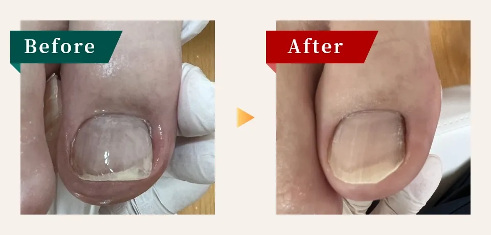 ビフォーアフター